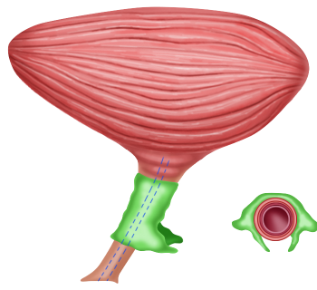 Sfintere uretrale - Fig. 4