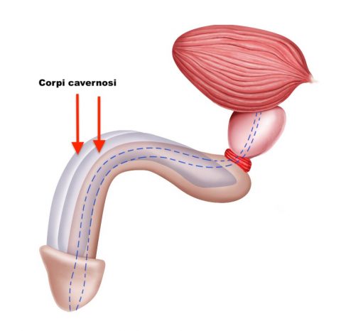 Pene curvo - Fig. 1